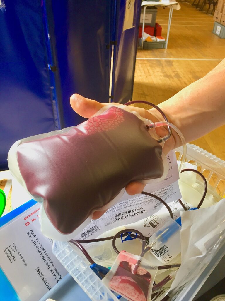 Bolsa de sangre recién donada (imagen de archivo)
