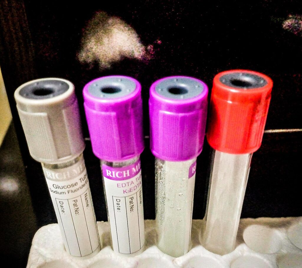 Tubos para muestras en un laboratorio clínico (imagen de archivo)