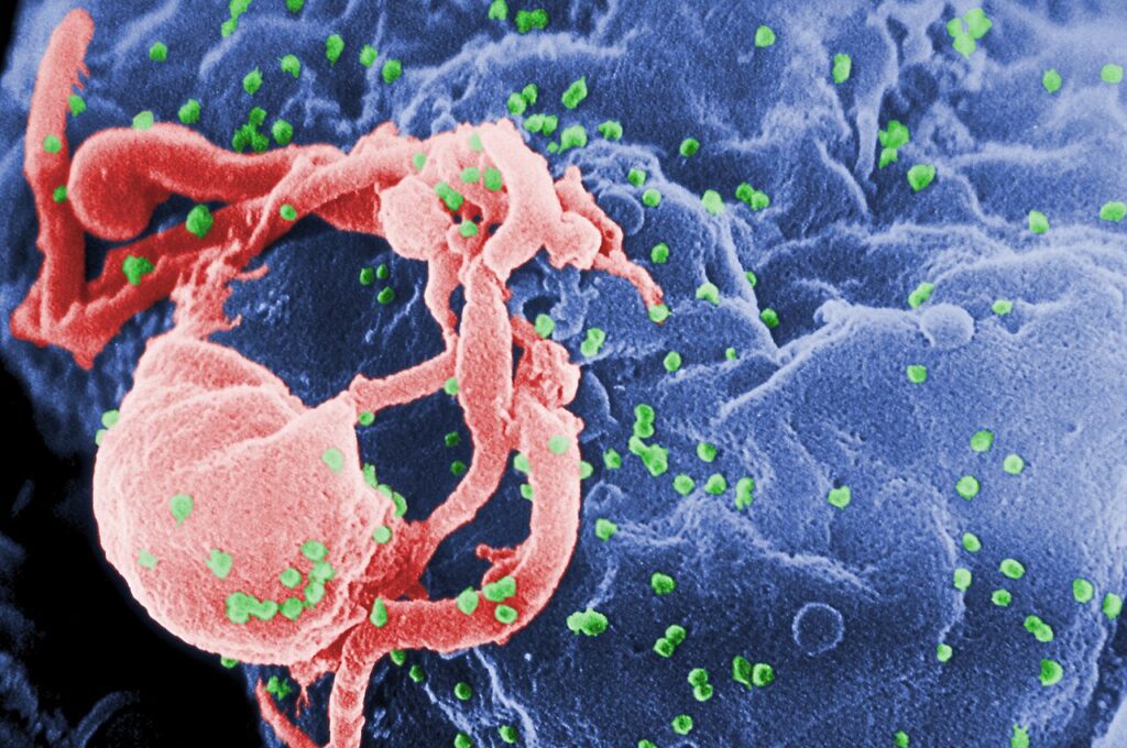 Imagen al microscopio electrónico del virus del VIH (imagen de archivo)