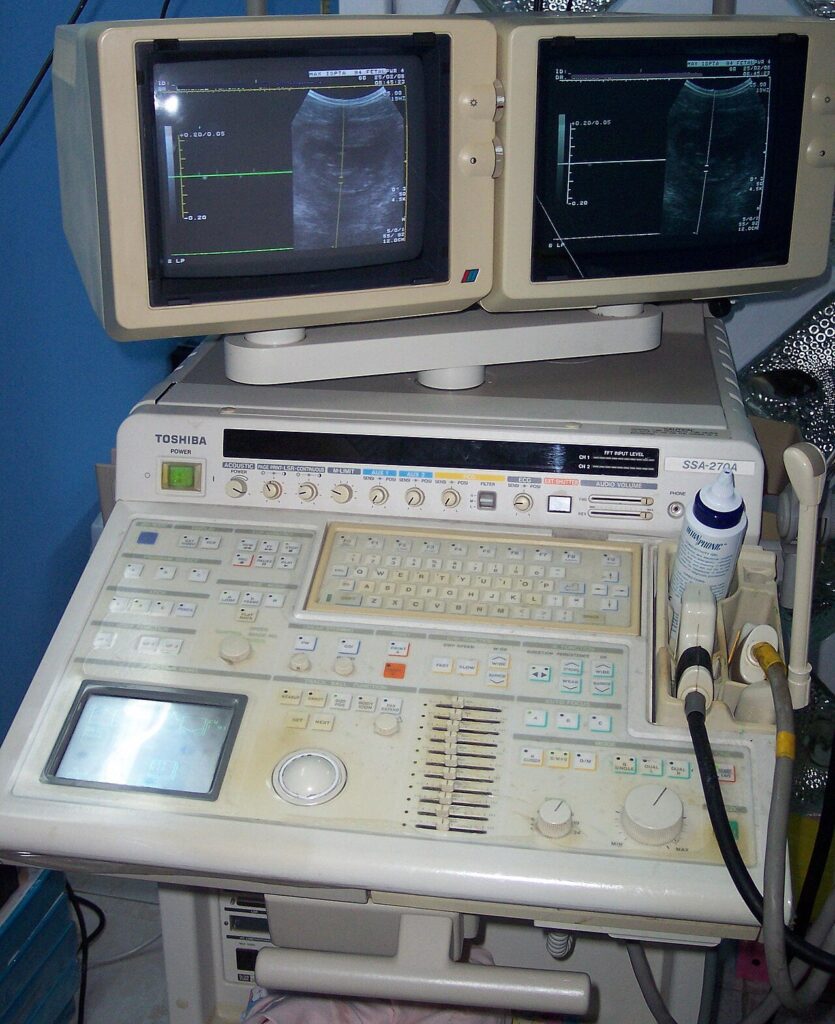Ecógrafo médico en una consulta