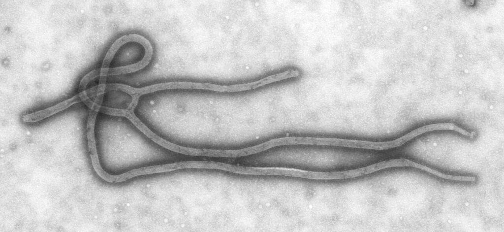 Imagen de microscopio electrónico de una partícula del virus del ébola