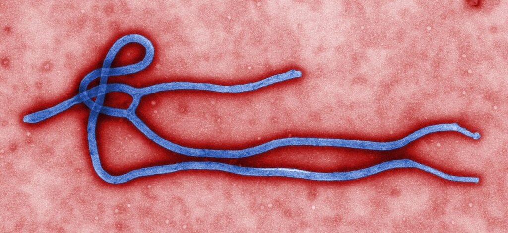 Imagen al microscopio electrónico del virus del ébola