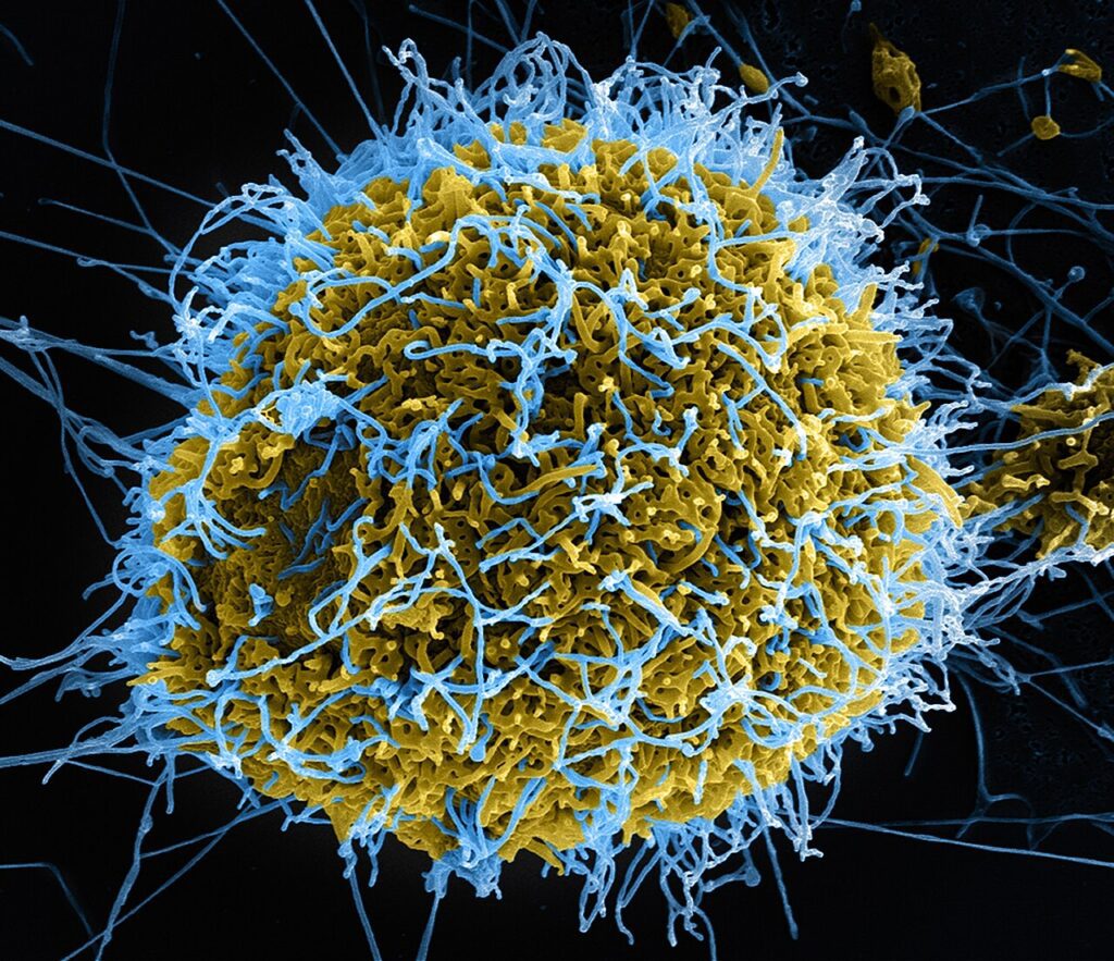 Partículas del virus del ébola vistas al microscopio electrónico