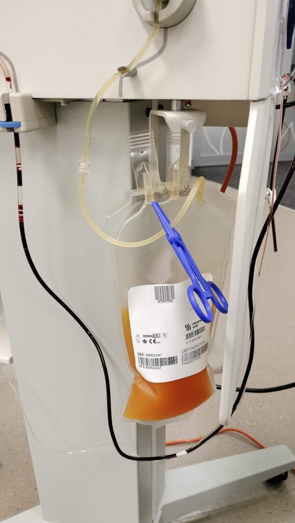 Bolsa de plasma obtenida en una donación
