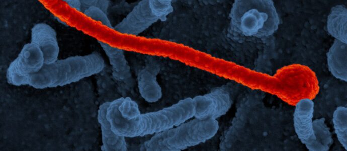 Nigeria confirma su primer caso de ébola y el brote del Congo llega a una octava provincia